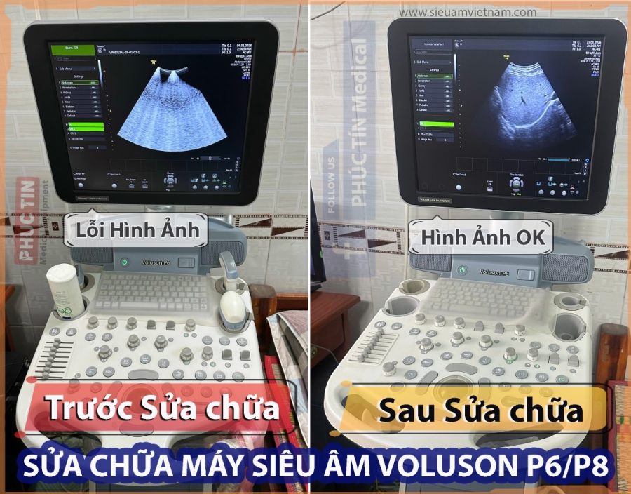 Dịch vụ sửa chữa máy siêu âm