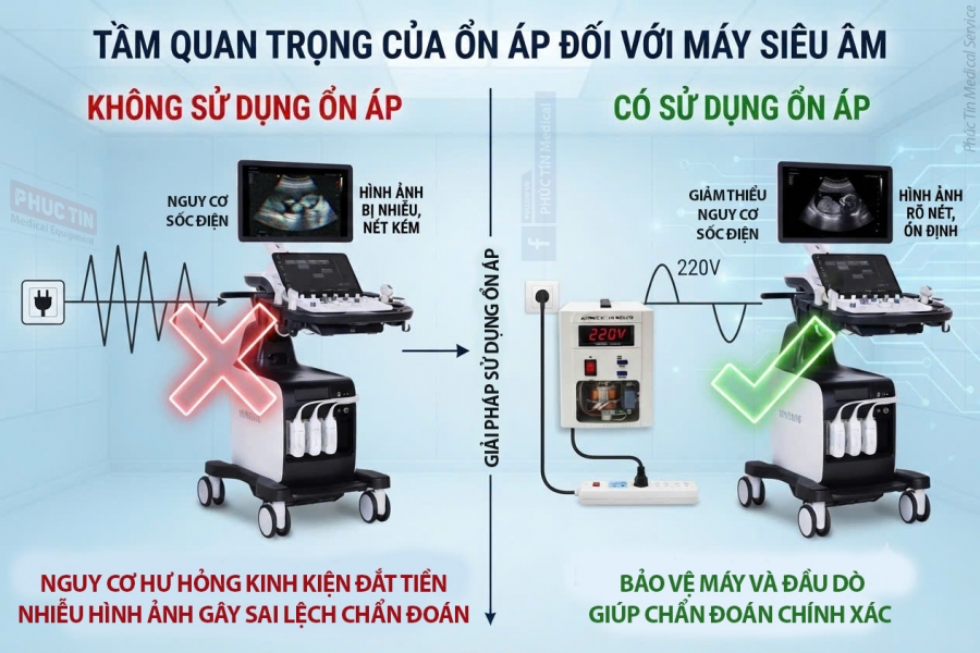 Máy siêu âm có cần sử dụng ổn áp ?