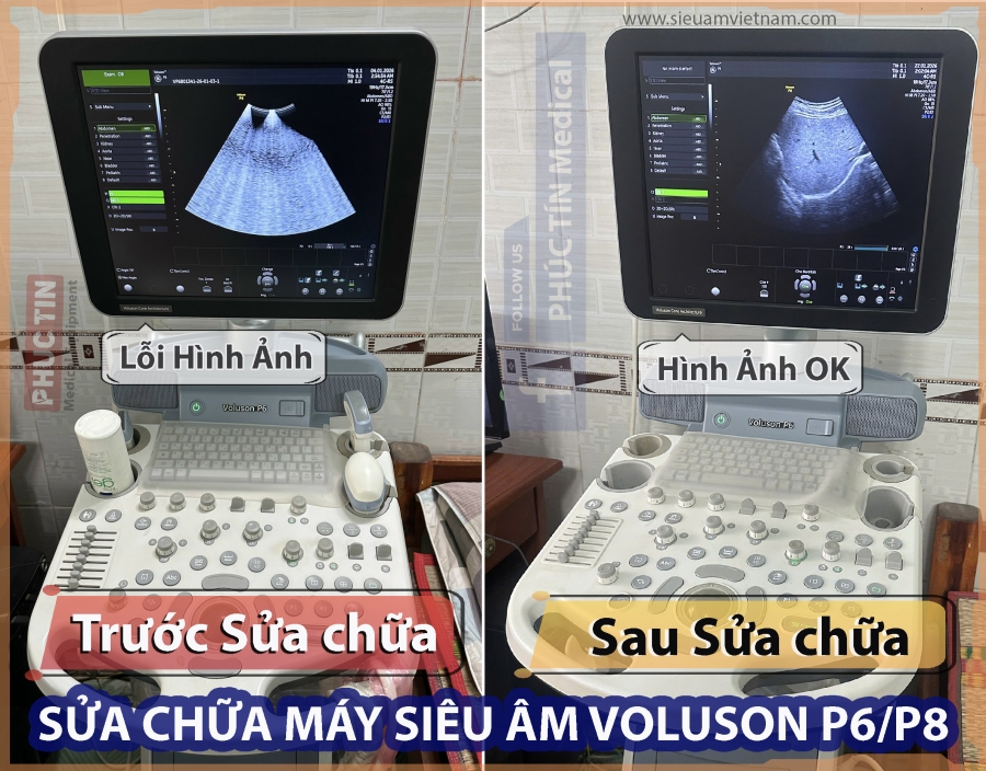 SỬA CHỮA MÁY SIÊU ÂM GE VOLUSON P8